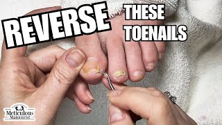 Pedicure at Home Toenail Cleaning nails satisfying [upl. by Mahseh]