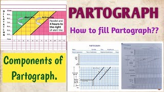 PARTOGRAPH COMPONENTS OF PARTOGRAPH HOW TO FILL OR PLOT PARTOGRAPH [upl. by Joao]