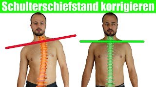 Schulterschiefstand beheben  Krumme Wirbelsäule  Brustkorb aufrichten [upl. by Rankin931]