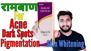 Acne Scars Pimple Marks Pigmentation Skin Whitening By Glyco 6 Cream Glycolic Acid Review [upl. by Aratak]