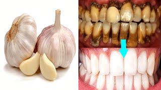 How to whiten teeth naturally at home with Garlic and Lemon [upl. by Ycram59]