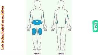 How to inject Insulin [upl. by Froma]