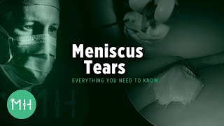 Meniscus Tears  Everything you need to know [upl. by Biggs]