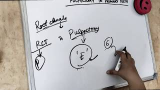 pulpectomy procedure in primary teeth special rct [upl. by Gavra]