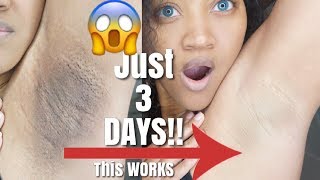 Watch How I Lighten and Get Rid Of My Dark Armpits FAST Before and After Results [upl. by Danella]