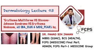 Erythema Multiforme VS SJS VS Erythema Nodosum all differentiating SBA amp MCQ ClueDrFahadFCPSP1MG [upl. by Iat]