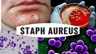 Staphylococcus aureus  staphylococcus infection  causes symptoms [upl. by Fellner]