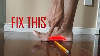 ARE ORTHOTICS THE SOLUTION HOW TO FIX FLAT FEET [upl. by Yatnuhs709]