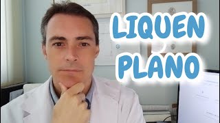 Dermatólogo explica lo que debes conocer sobre el liquen plano [upl. by Richmound366]