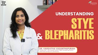 The Truth About Styes amp Blepharitis Causes Treatments amp Relief  Dr Varshitha  English [upl. by Whitelaw]