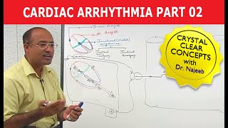 Cardiac Arrhythmia  Part 23 [upl. by Odravde]