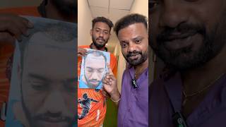 4 Month Amazing Hair Transplant Results  Tamil Hair Transplant  Sukira Aesthetic  Coimbatore [upl. by Laban366]