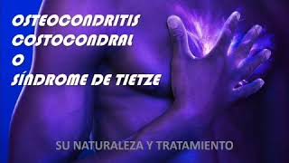 Osteocondritis Síndrome de Tietze [upl. by Marchak]