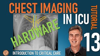 Chest Imaging in ICU  Part 2  Hardware [upl. by Enair]