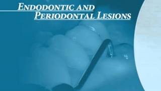 Endodontics Torabinejad 60 Endo Perio Introduction [upl. by Llehcear]