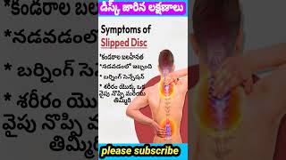 డిస్క్ జారినప్పుడు వుండే slipped disc లక్షణాలు [upl. by Stace]