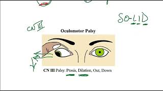 Video 220 Ocular Muscle Innervation amp Cranial Nerve Lesions Anatomy Function amp Clinical Correlates [upl. by Brazee]