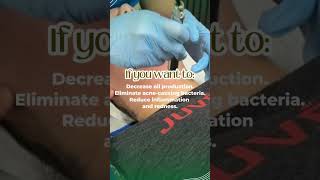 Photodynamic Therapy  Acne Photodamage and Redness Treatment in Seattle [upl. by Enirod]