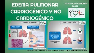 EDEMA PULMONAR CARDIOGÉNICO Y NO CARDIOGÉNICO  GuiaMed [upl. by Asyle]