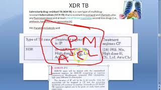 PSM 185 Previous OLD treatment regimen for XDR TB Extended drug resistant Tuberculosis treatment [upl. by Vickey]