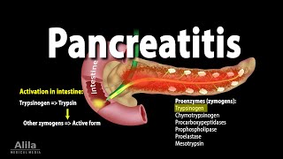 Pancreatitis Acute and Chronic Animation [upl. by Gris897]