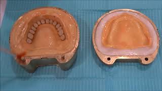 Processing of Complete dentures [upl. by Nerak]