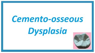 Cementoosseous Dysplasia  Important Notes  Diseases of Bone and Joint 4  Oral Pathology [upl. by Jaddan]