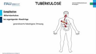 Pathologie ─ Tuberkulose [upl. by Traver]