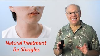 Natural Treatment for Shingles [upl. by Moberg]