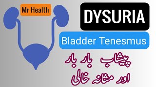 Dysuria And Bladder Tenesmus Treatment  Painful Frequent Urination In Drops [upl. by Sucrad]