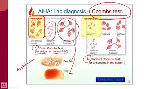 Hematology  2  U1L11  Coombs test [upl. by Childs]