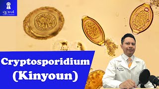 Conoce a Cryptosporidium Morfología y CLAVES para su identificación🔬 [upl. by Ydal491]