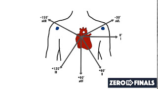 Understanding ECG Axis and Axis Deviation [upl. by Acissj305]