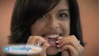 Invisalign and Invisalign Teen  How it Works and What to Expect [upl. by Lopez454]