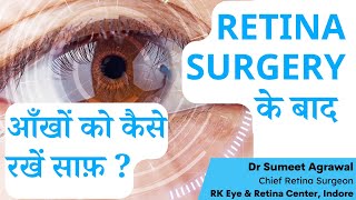 RETINA SURGERY के बाद आँख की साफ़  सफाई कैसे करें  How to clean eyes after retina surgery [upl. by Aihset]