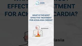 Most Effective Ways to Treat Achalasia Cardia  Dr Aditya dradityakulkarni achalasiacardia [upl. by Iran]