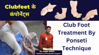 टेड़े मेड़ें पाँव का इलाज Ponseti Technique द्वारा कैसे किया जाता है  Clubfoot  CTEV Treatment [upl. by Anastatius]