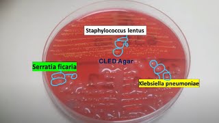 Staphylococcus lentus Klebsiella pneumoniae and Serratia ficaria on CLED Agar of Urine Culture [upl. by Engleman]