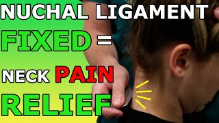 Nuchal Ligament FIXED  Neck Pain RELIEF [upl. by Idnaj]