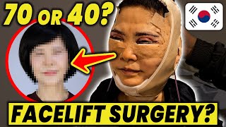 Unbelievable Korean Facelift Before amp After Mommy Makeover  Plastic Surgery in Korea vlog Part2 [upl. by Isabelita608]