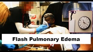 Flash Pulmonary Edema Emergency [upl. by Urania353]