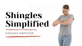 Shingles Simplified [upl. by Etselec]