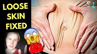 LOOSE SKIN HELP 😱 How to Lose Loose Skin After Weight Loss [upl. by Alor]