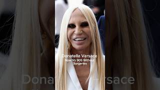 Donatella Versace Now VS Without Surgeries 90s donatellaversace versace shortsfeed runway [upl. by Anirroc]