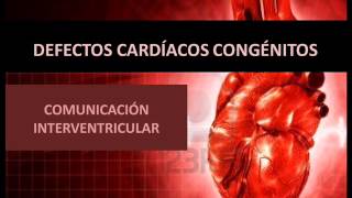 Defectos cardíacos congénitos  Comunicación interventricular [upl. by Suirrad]