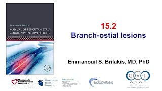 152 Branch ostial lesions  Manual of PCI [upl. by Kenlay633]