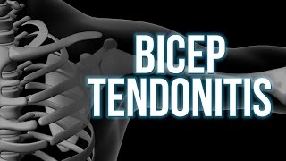 Bicep Tendonitis 3 steps to start the healing [upl. by Intyre815]