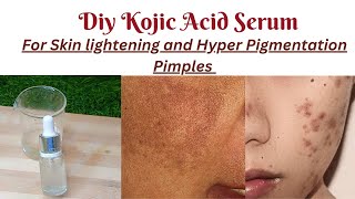 Diy Kojic Acid SerumHomemade Kojic Acid Serum makingKojic Acid Serum [upl. by Warms]