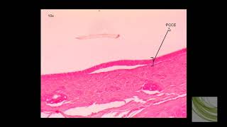 SLIDE Pseudostratified Ciliated Columnar Epithelium PCCE [upl. by Jaquenette653]