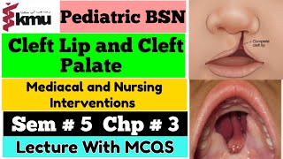 Cleft Lip and Cleft Palate  Pediatric Health NursingChap  3  BSN Sem 5th With MCQS Farman KMU [upl. by Kristyn]